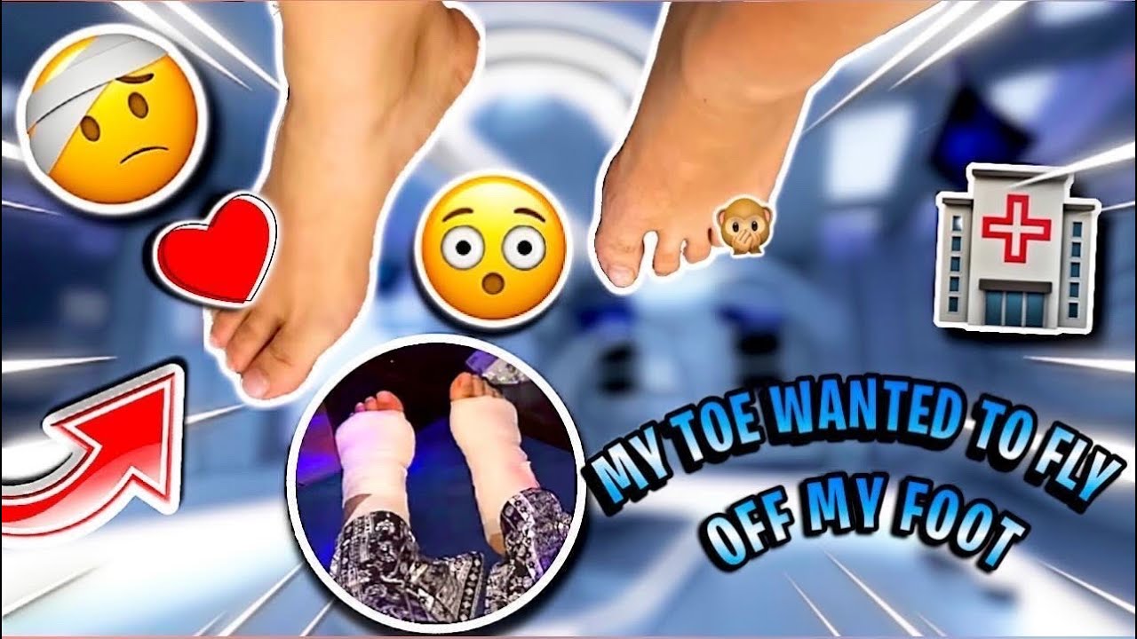 Little toe surgery! (Before and after) -Jailyne Ojeda